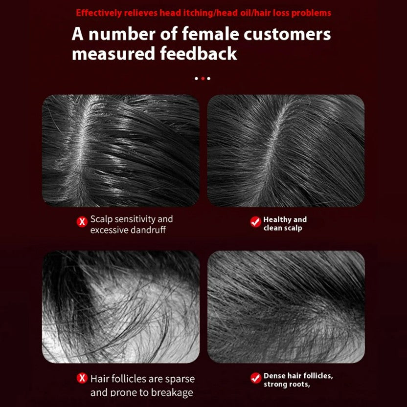 Electric Vibration Massage Comb Portable Hair Follicle Comb