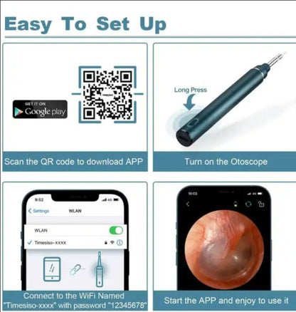 Earwax Remover with Camera