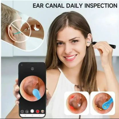 Earwax Remover with Camera